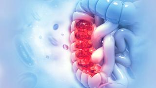 Colorectal Cancer Awareness Month