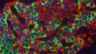 Islet Cells - small low res 300x140