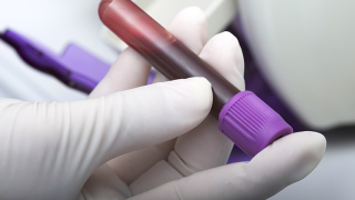 liquid_biopsy_blood_sample
