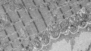 Electron Microscopy