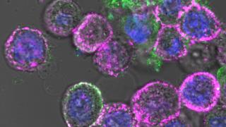 Oncolytic CAR T Under Microscope