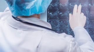 Pancreatic cancer imaging | City of Hope