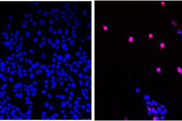 AOH1996 targets a cancerous variant of the protein PCNA; programmed cell death